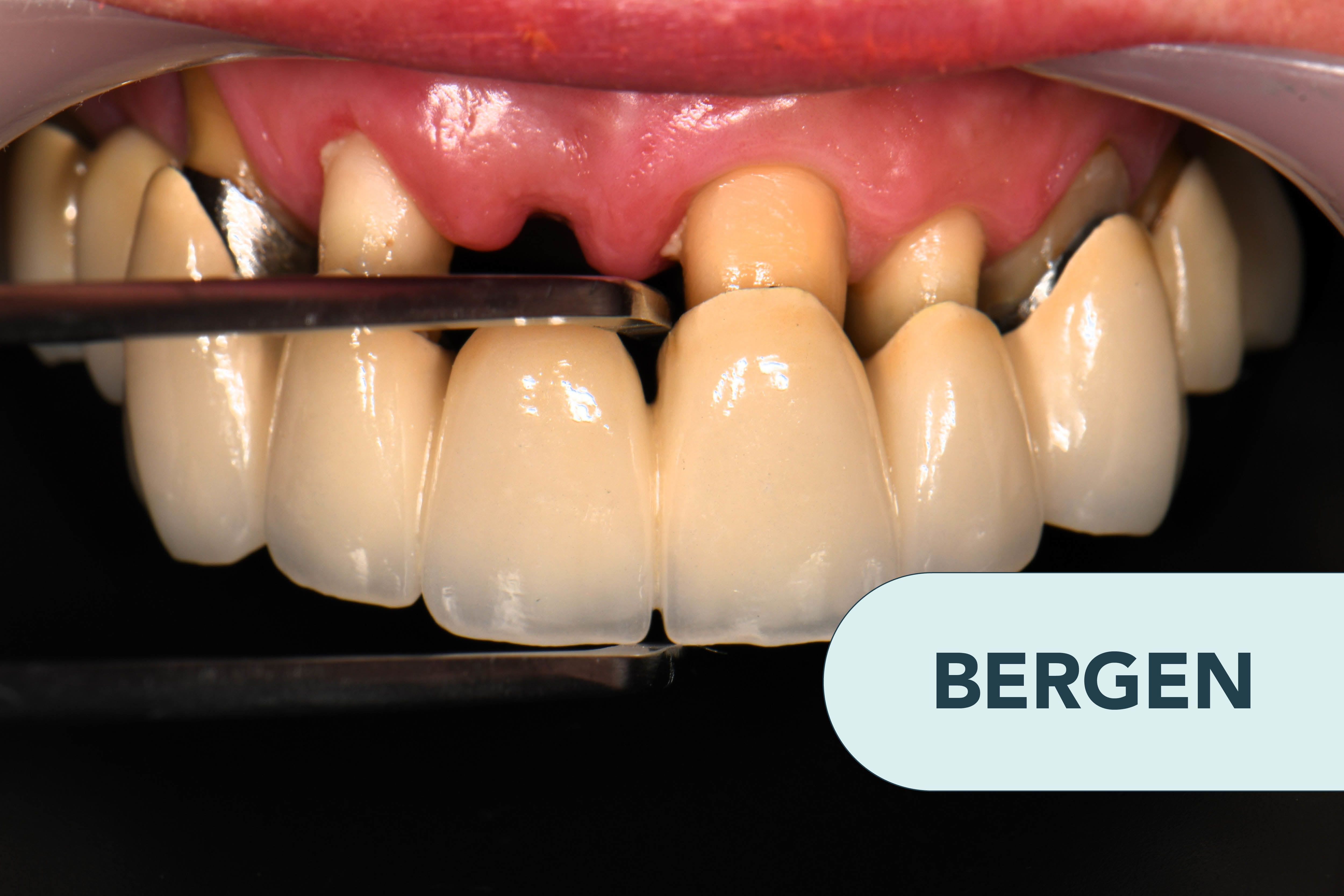 Kurs Jacobsen Dental