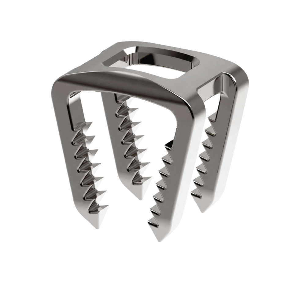 CONTINUUM™ ACDF Staple – Dynamic fusion design with interactive hotspots