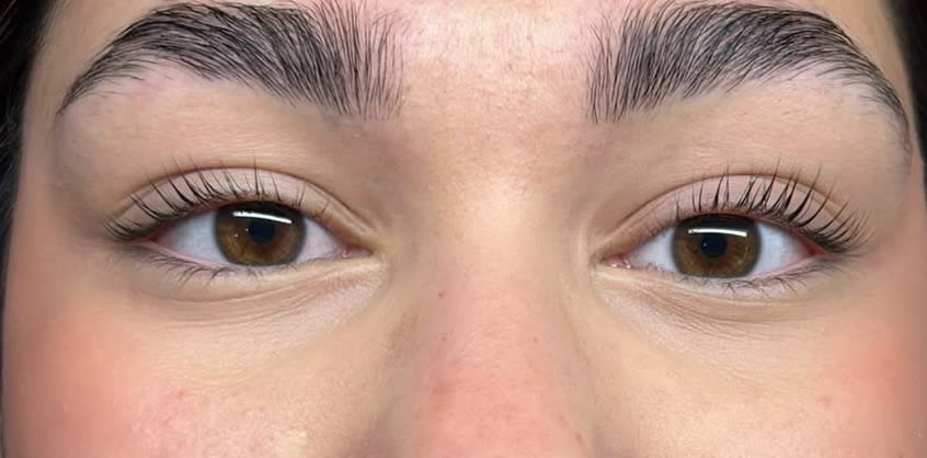 Procedimento de limpeza de pele na Adri Moraes Estética, em São José - SC