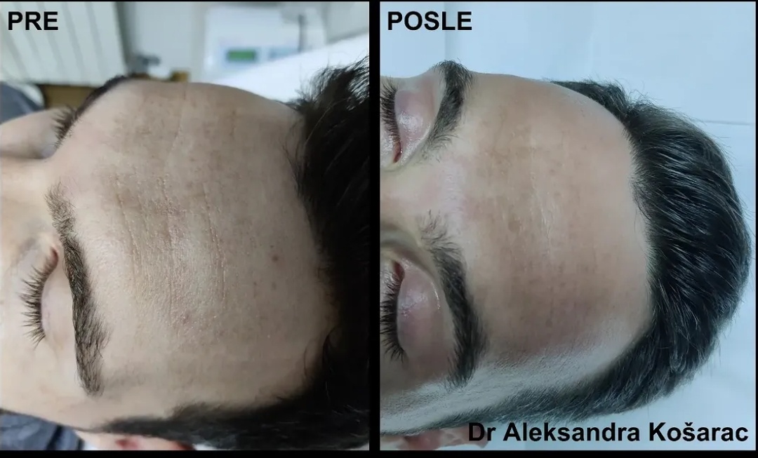 Rezultat 2