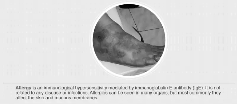 Image from analysis Uploaded image analysis
