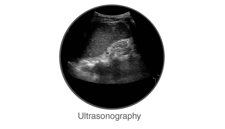 Ultrasonography medical imaging