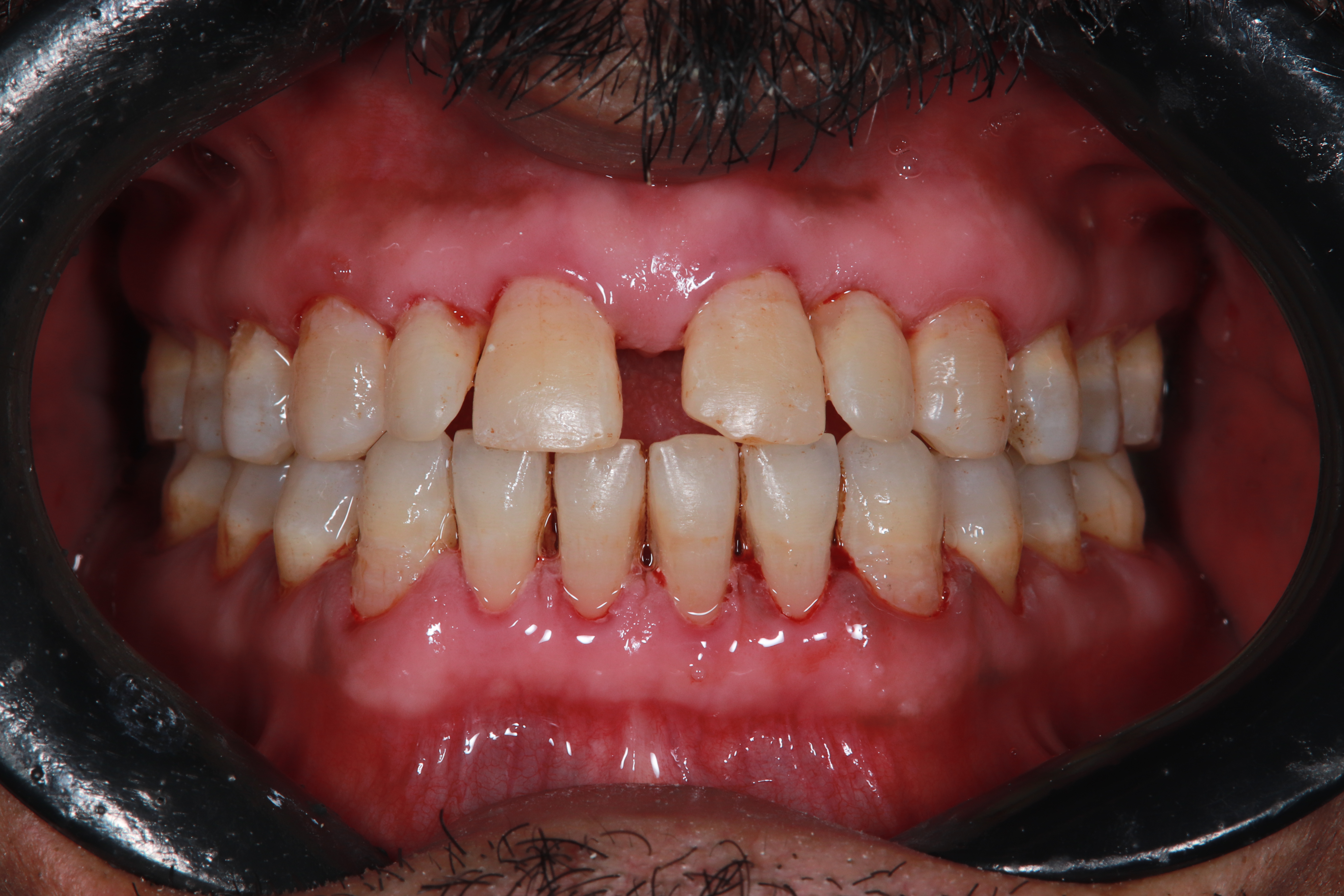 Premium Cosmetic Transformation - After