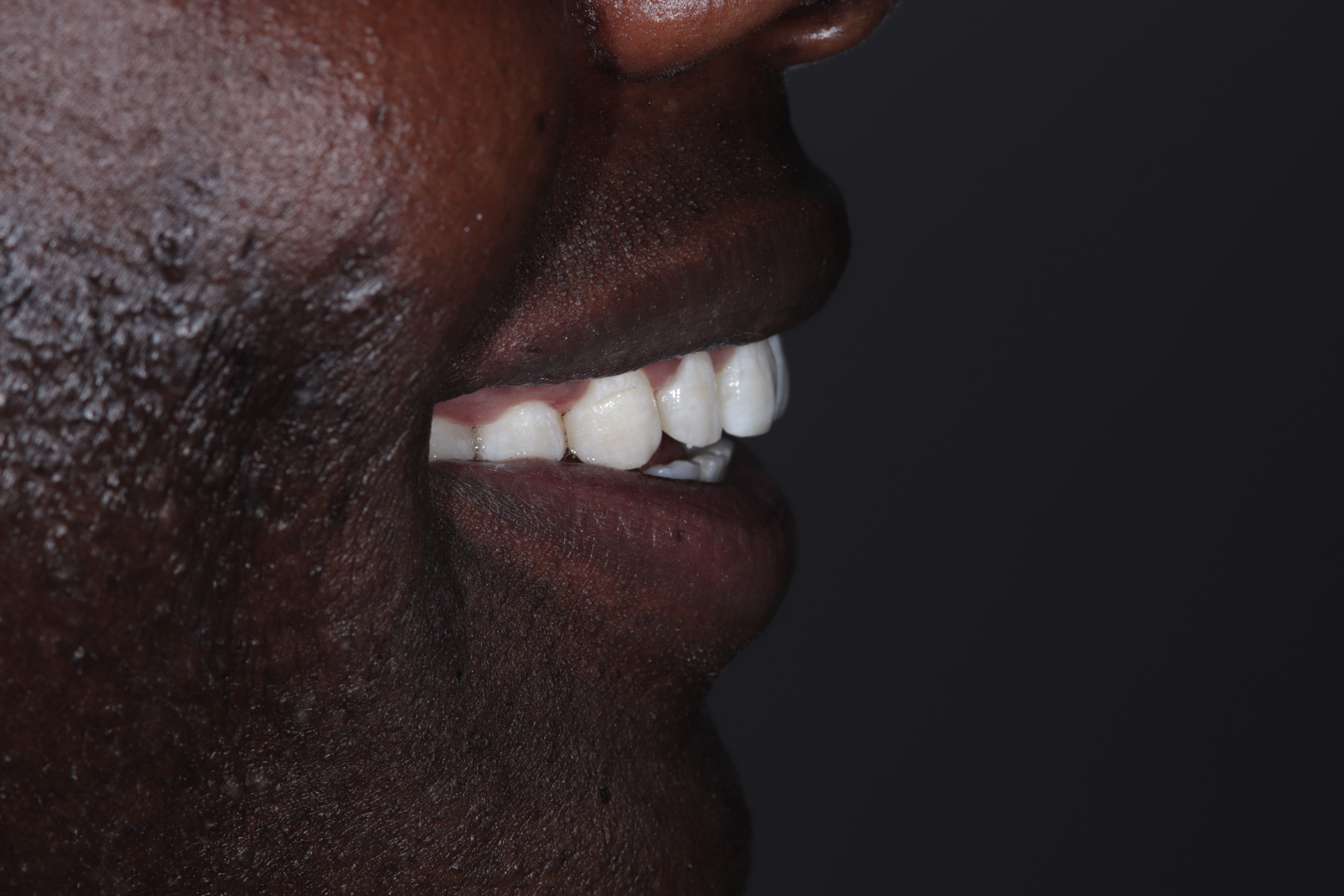 Premium Cosmetic Transformation - After