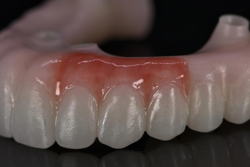 ����� Bloomden Gingival Pink ����� �������� �������� ���� ���� ������� �� ��������. ������� �������� Lumix-3D ������� ��Gum Kit ������ ������ ������� ����� �� ���� ���-���� �����.