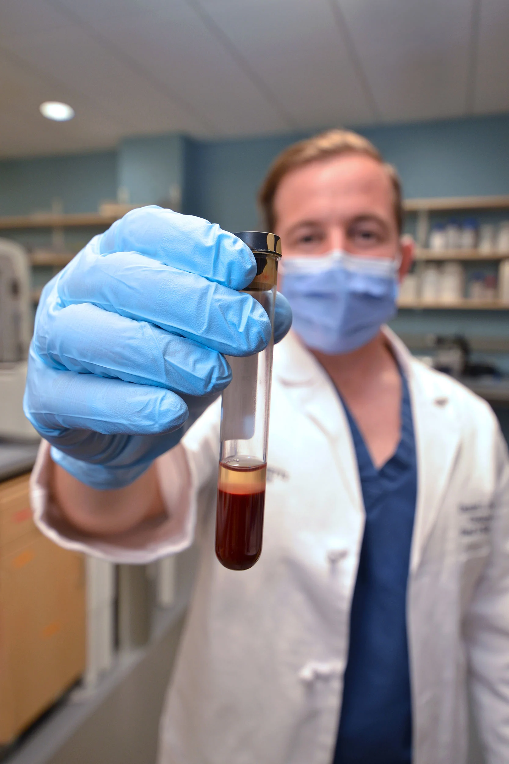 An illustrative image related to liquid biopsy, highlighting technological advancements contributing to early detection of HPV-linked cancer through blood testing.