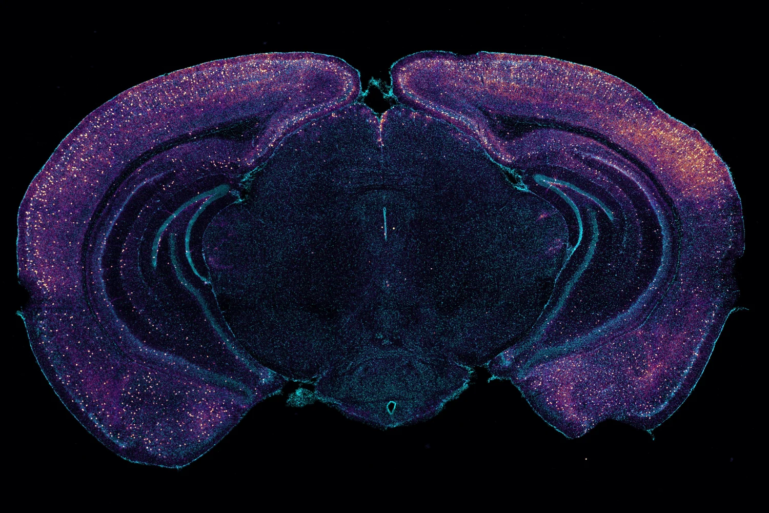 Detailed microscopy image highlighting VIP neurons in a mouse brain, representing the circadian components involved in Alzheimer's research.