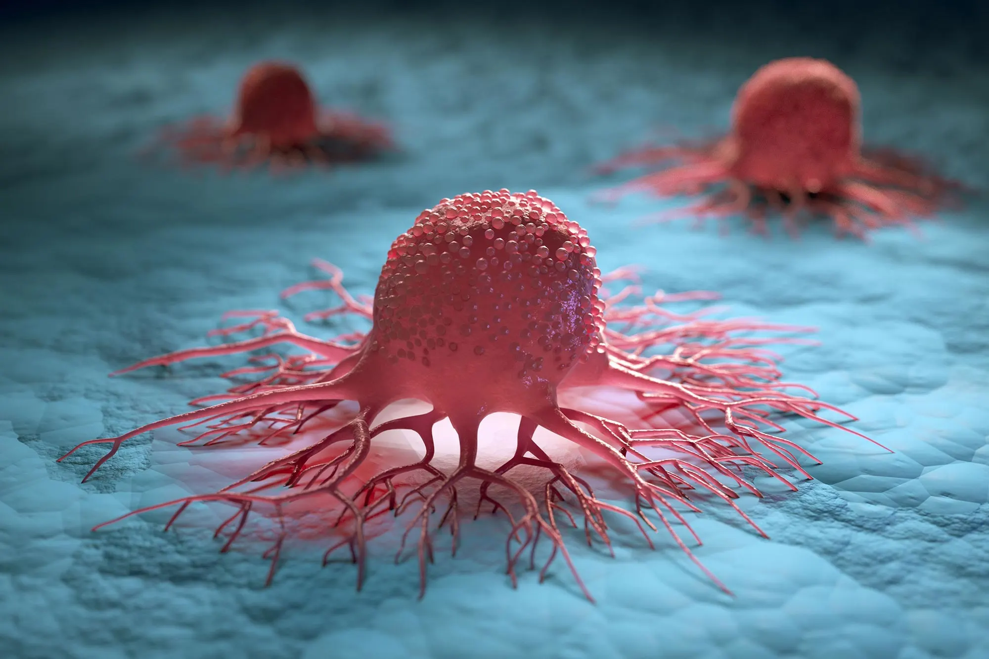 Detailed rendering of cancer cells showing dynamic behavior, emphasizing possible roles in cell migration and metastasis.