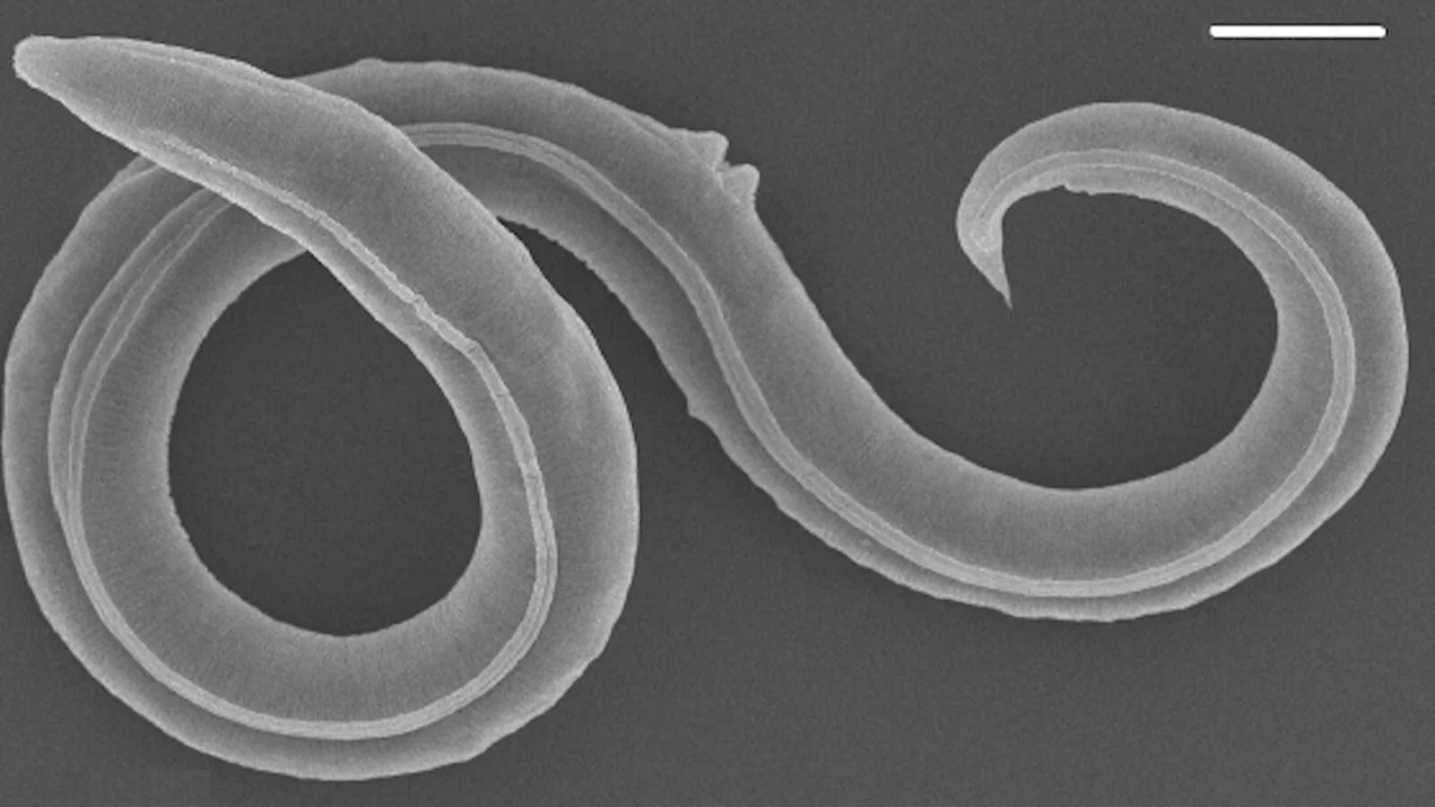 High-quality close-up image of a C. elegans worm, visually aligning with the subject of longevity research.