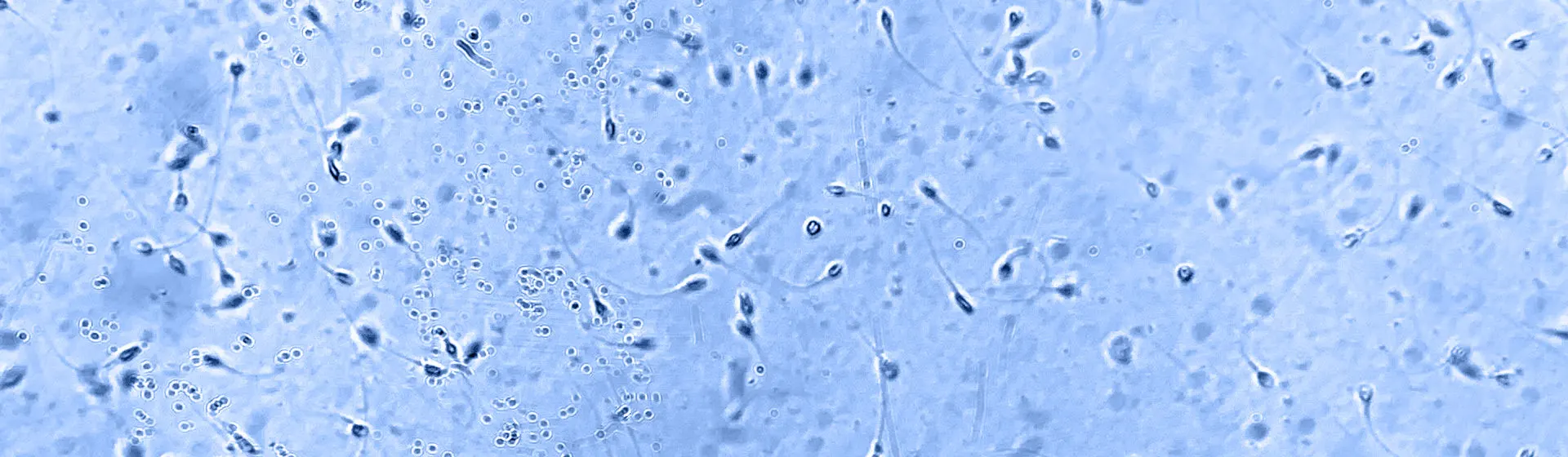 High-quality stock image depicting a DNA strand in blue tones, ideal for illustrating genetic mutation or biotechnology subjects.
