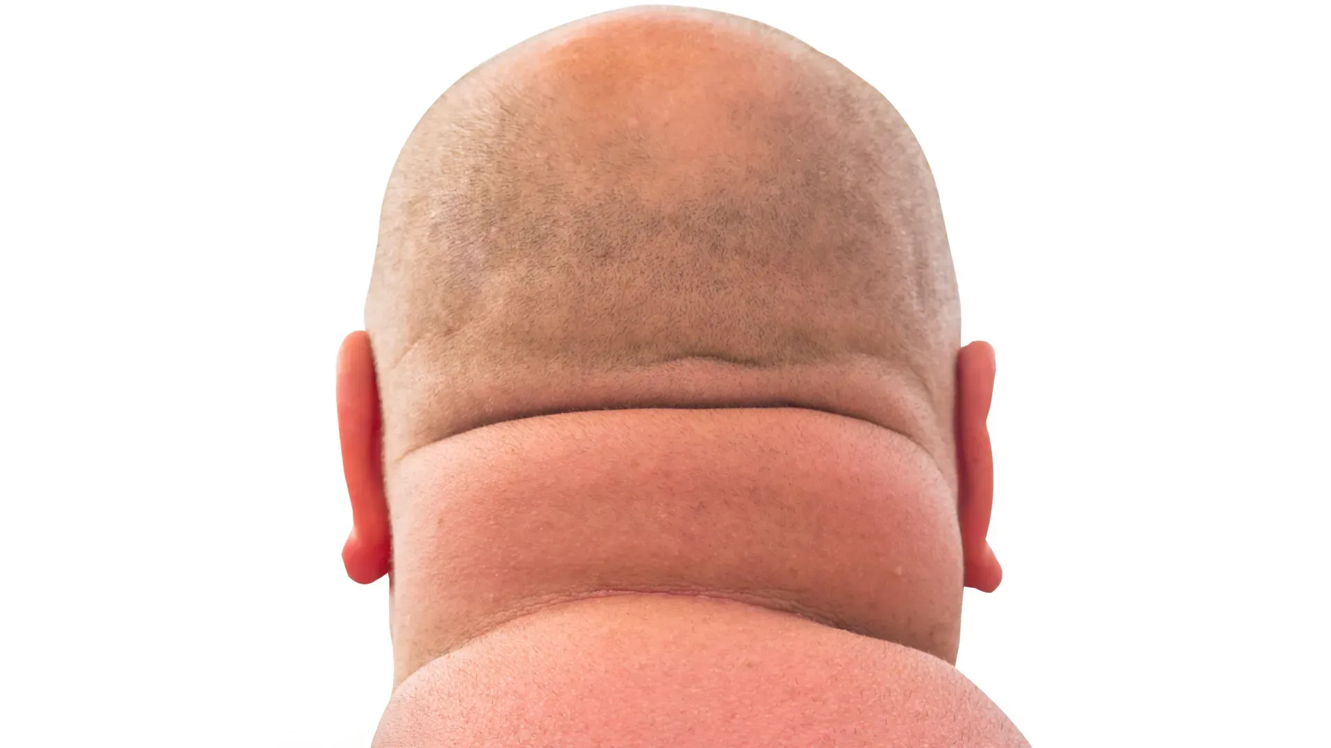 Webp image showing an overweight bald man with a thick neck, visually representing the correlation between neck size and health risk.