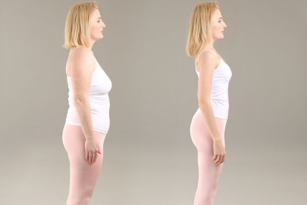 a woman before and after weight loss