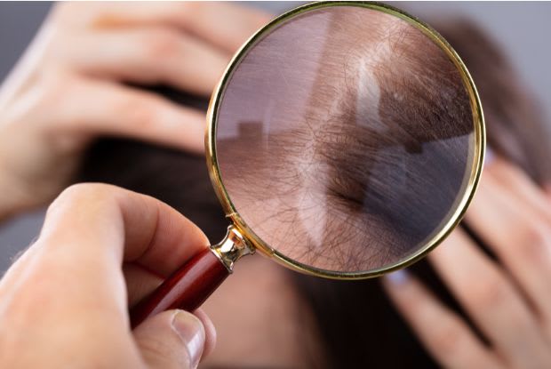 doctor checking hair with magnifying glass
