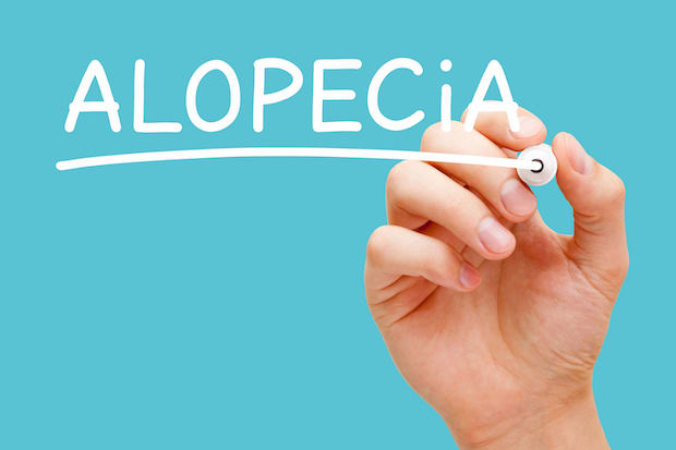 the word "alopecia" on a baby blue background