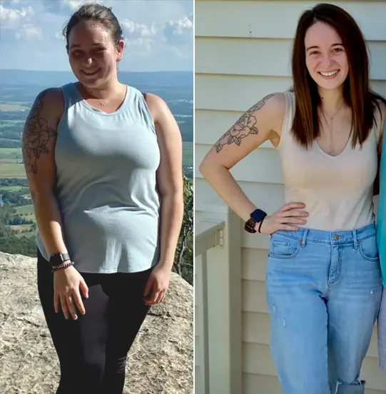 Before and after images of woman smilling posing for a photo