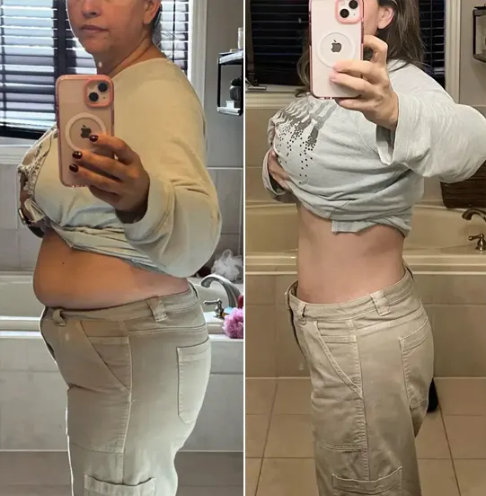 Before and after images of woman taking a photo of herself while lifting her clothes showing her stomach