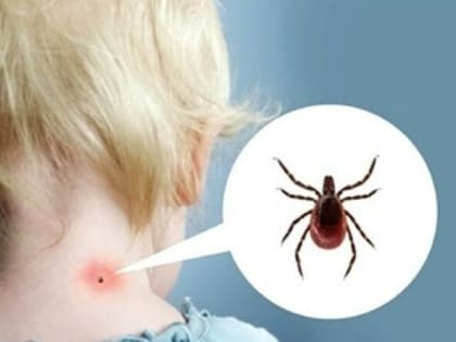 Осторожно – клещи наступают