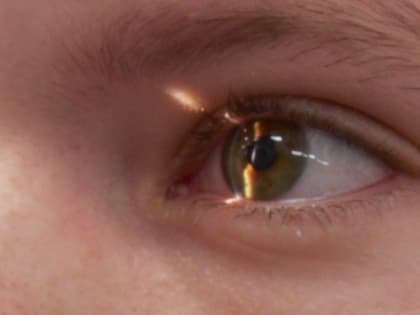 Полное обследование глаз организовали в Мещовске для детей с нарушением зрения