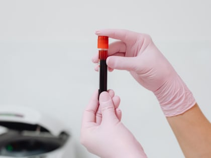 В Калуге срочно ищут доноров крови