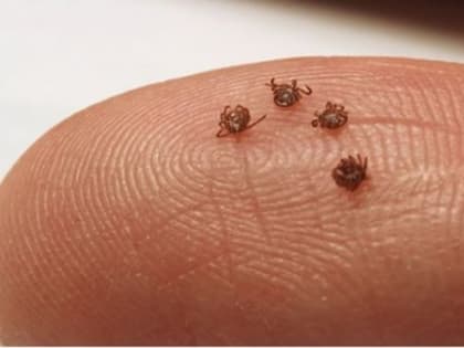 Клещи начали переносить новый опасный вирус Хасеки. Медики рассказали, грозит ли он калужанам