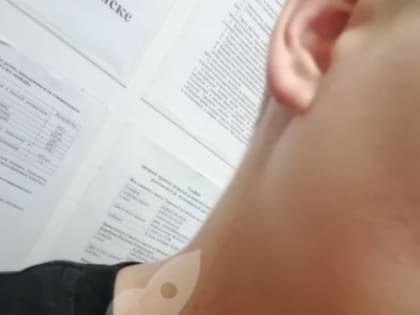 Школьная драка на Байконуре: травмы и недовольство родителей