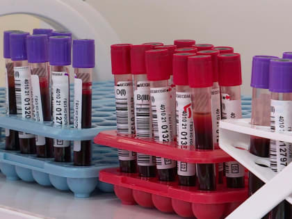 Неделя борьбы с вирусным гепатитом С стартовала в Калужской области