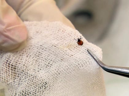 Клещи наступают: в Калужской области вдвое выросло число зараженных болезнью Лайма