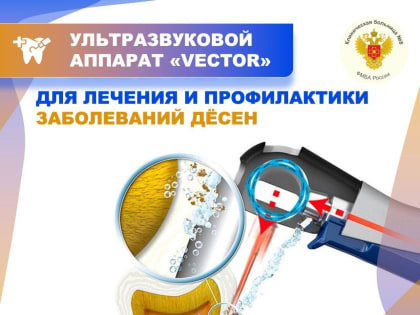 Лечение дёсен аппаратом Vector: преимущества и эффективность