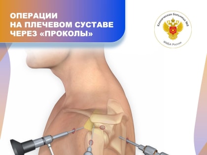 Операции на плечевом суставе через «проколы»