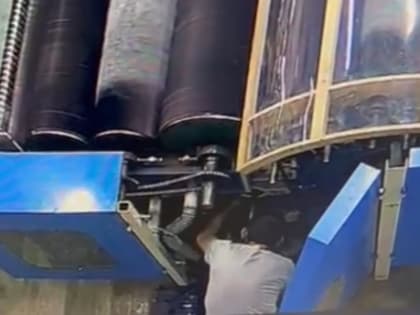 Рабочему текстильного предприятия ампутировало руку