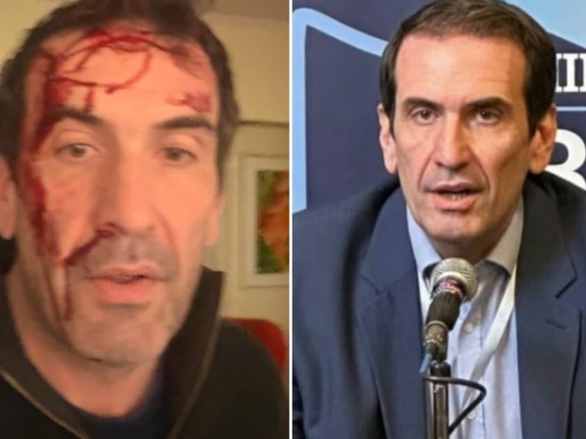 El diputado Pablo Cervi fue víctima de un ataque a horas de las elecciones