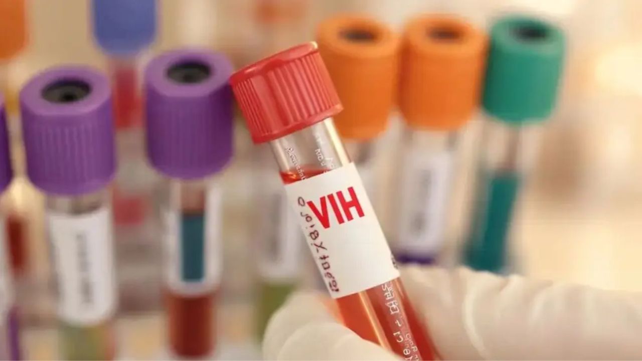 VIH en Argentina: 17 diagnósticos diarios y la urgencia de reforzar la prevención