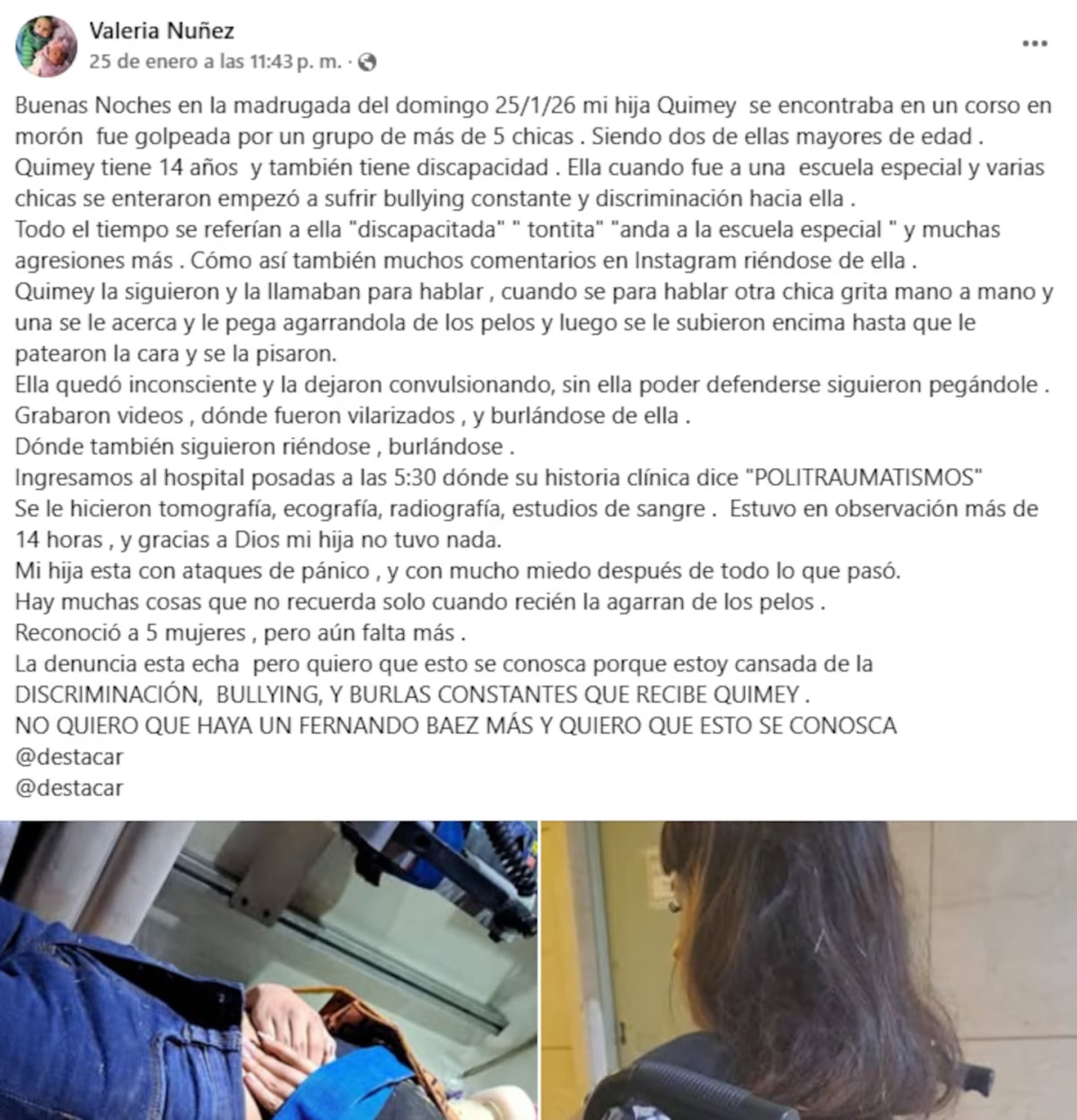 el-relato-de-la-madre-de-la-victima-en-sus-redes-sociales-foto-facebookvaleria-nunez-RBYZWVTY5NA4FBSKKGXHLE3UHA.avif