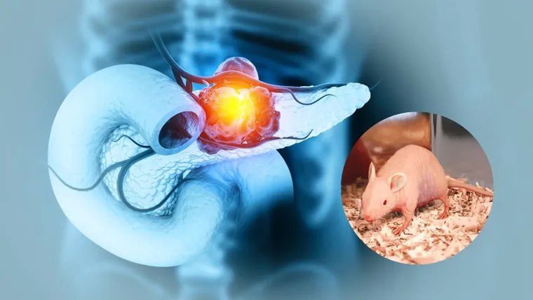 Investigación española abre una nueva etapa en la lucha contra el cáncer de páncreas