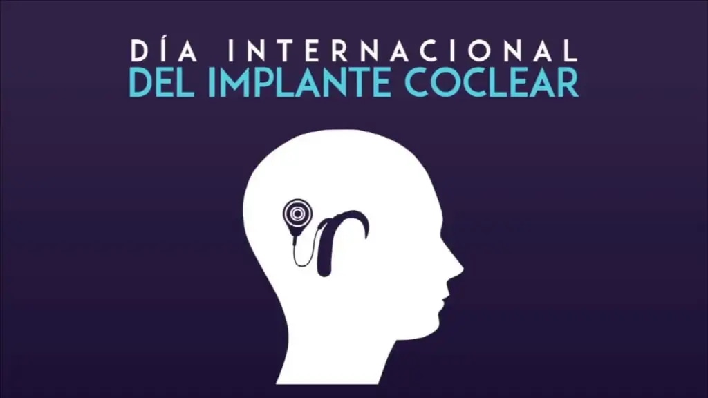 Día Mundial del Implante Coclear: la importancia de detectar y tratar a tiempo la pérdida auditiva