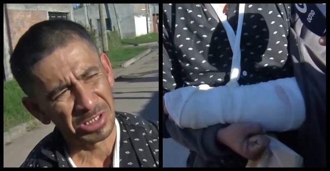 El trapito herido en barrio Sur necesita ayuda de los tucumanos para poder comprar los medicamentos