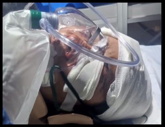 Una mujer salvó su vida porque su abusador creyó que la había matado