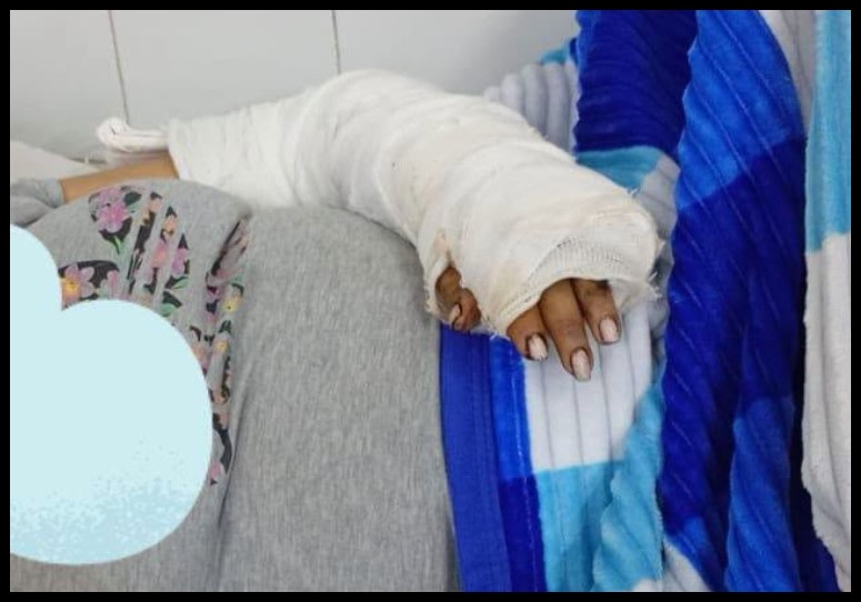 Santa Lucía: recibió el alta la joven atacada y continuará con tratamiento médico