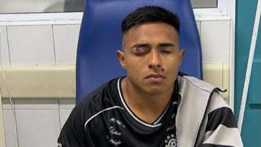Concepción  FC pidió esperar la recuperación de Axel González pero no tuvo éxito