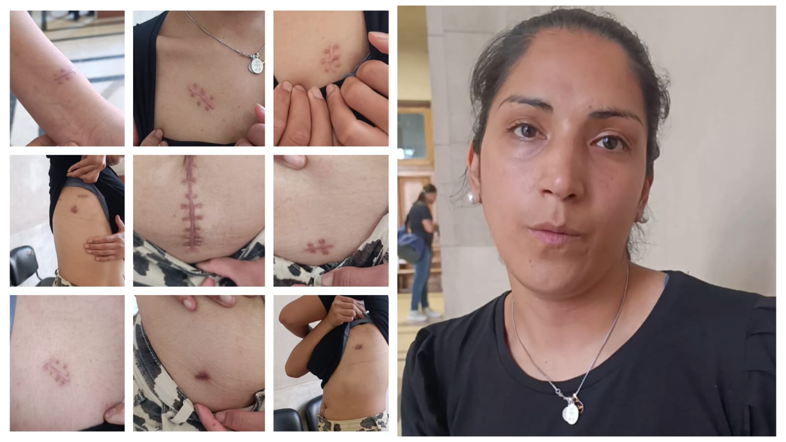 La docente que sobrevivió a las 15 puñaladas de su vecino se encontró con él al volver a casa