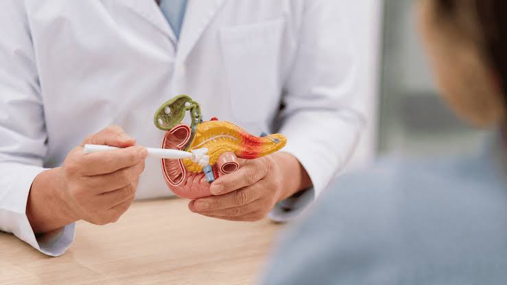 Un nuevo fármaco duplicó la sobrevida en cáncer de páncreas avanzado: qué falta para que llegue a la Argentina
