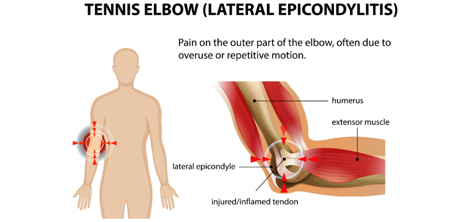 Osteopathy blog illustration
