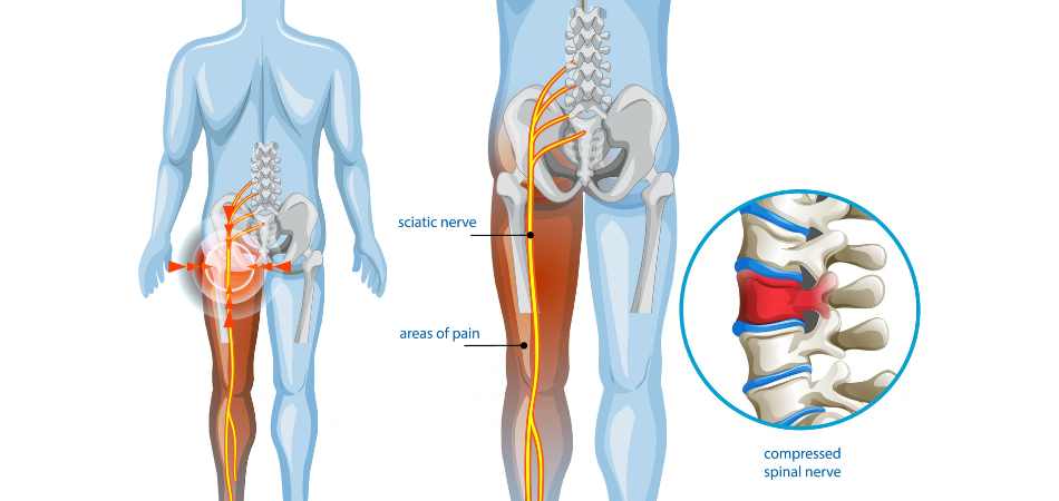 Osteopathy blog illustration