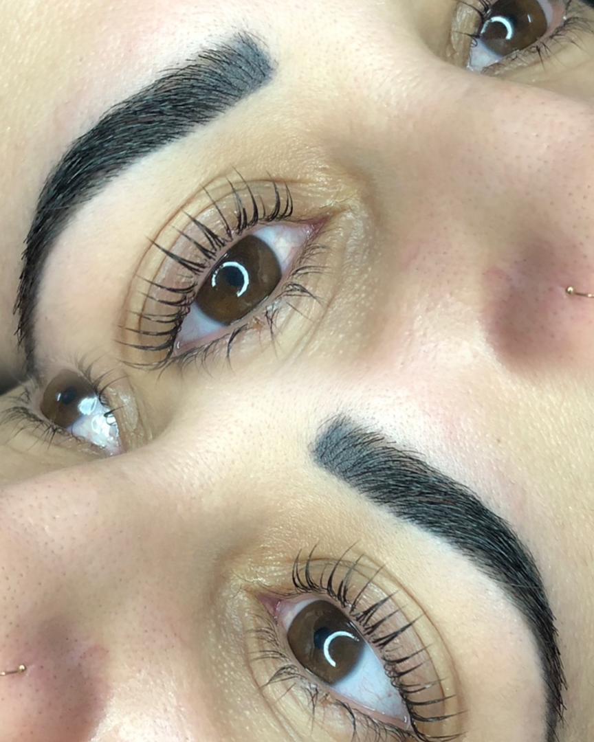 Resultado de tratamiento estético en Glam Studio