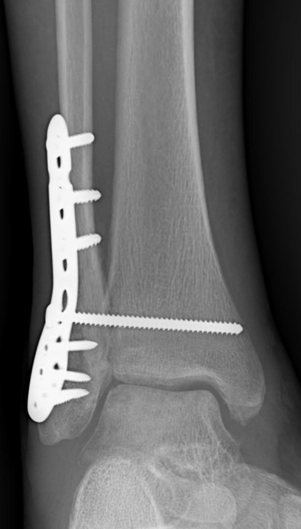 General & Complex Trauma