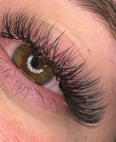 High Definition Esthetics