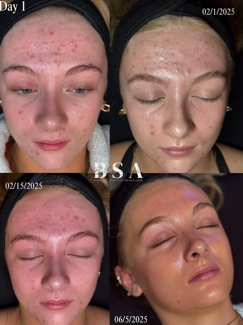 Bare Skin Aesthetics