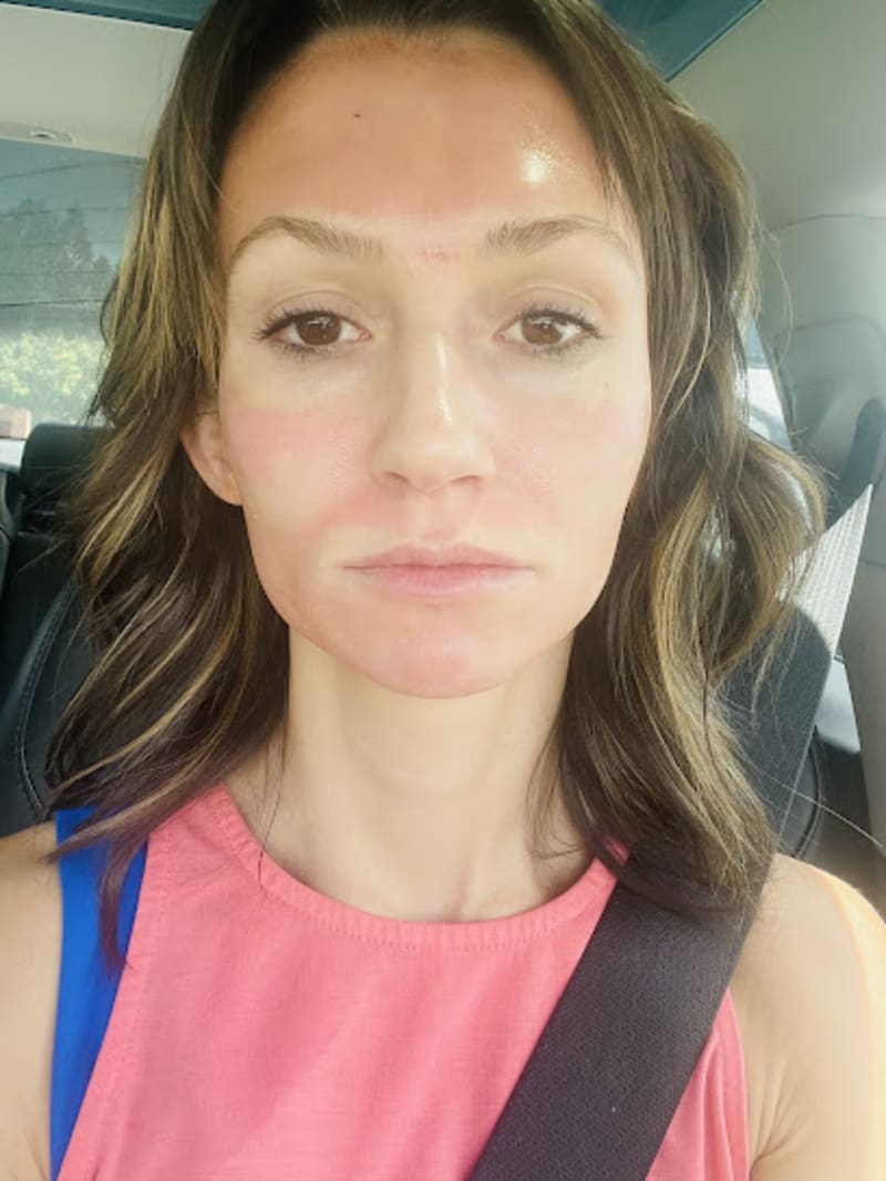 Advanced Medical Aesthetics Med Spa Parker CO