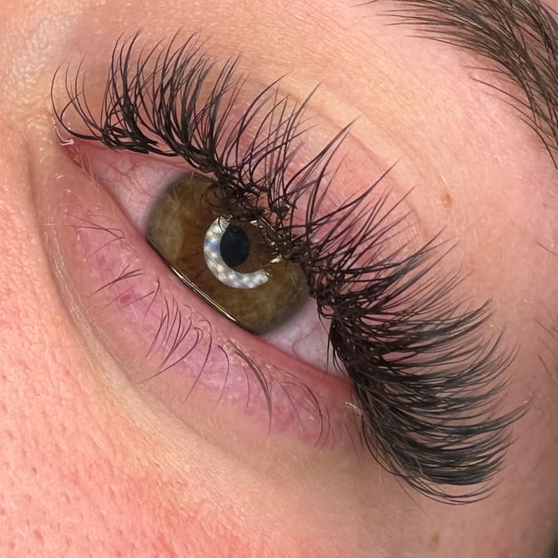 High Definition Esthetics