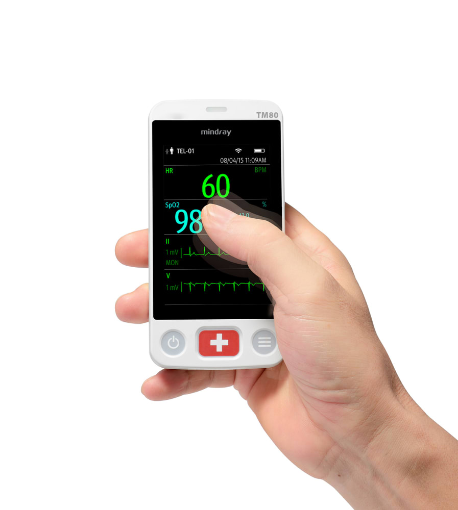 Monitor de telemetría